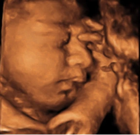 Eco 4D, Ecografía 4D, Eco para ver la carita del bebé